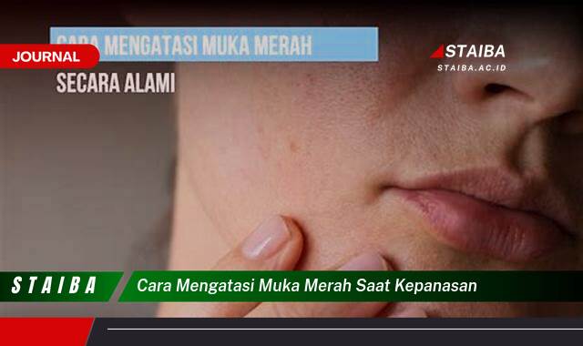 Ketahui Cara Mengatasi Muka Merah Saat Kepanasan dengan Cepat dan Alami Ketahui Cara Mengatasi Muka Merah Saat Kepanasan dengan Cepat dan Alami