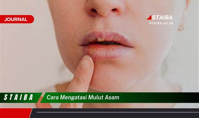 Ketahui Cara Mengatasi Mulut Asam dengan Cepat dan Alami