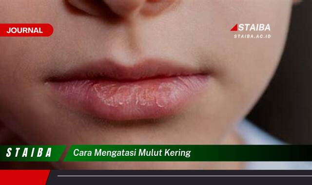 Ketahui Cara Mengatasi Mulut Kering Secara Alami dan Efektif