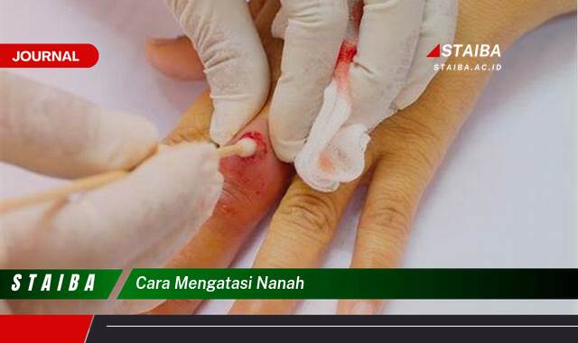 Ketahui Cara Mengatasi Nanah dengan Cepat dan Aman