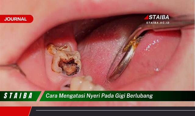 Ketahui Cara Mengatasi Nyeri Gigi Berlubang Secara Alami dan Cepat