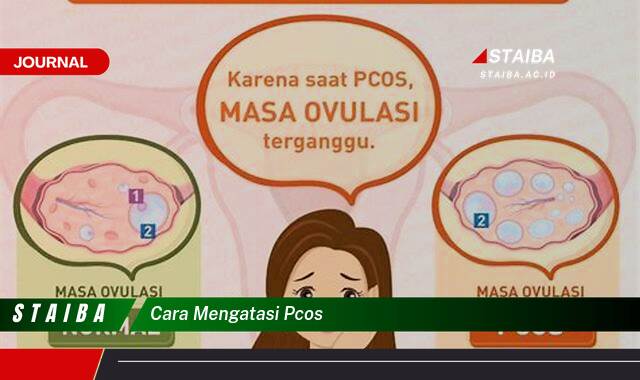 Ketahui Cara Mengatasi PCOS Secara Alami dan Efektif Ketahui Cara Mengatasi PCOS Secara Alami dan Efektif