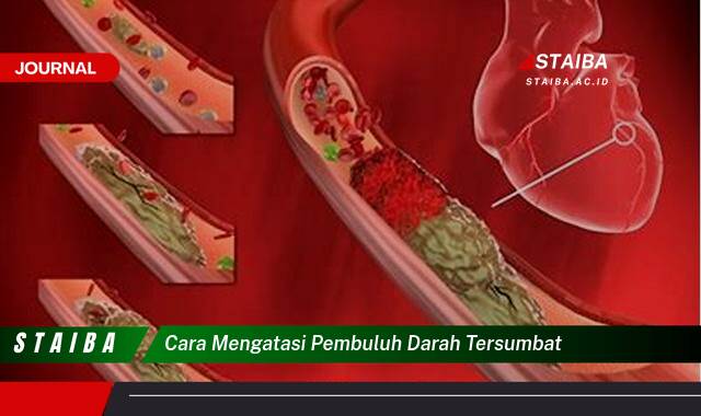 Ketahui Cara Mengatasi Pembuluh Darah Tersumbat Secara Alami dan Medis Ketahui Cara Mengatasi Pembuluh Darah Tersumbat Secara Alami dan Medis