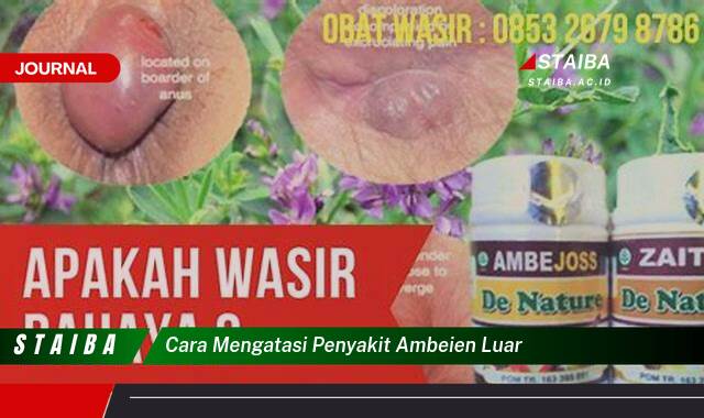 Ketahui Cara Mengatasi Penyakit Ambeien Luar Secara Alami dan Cepat