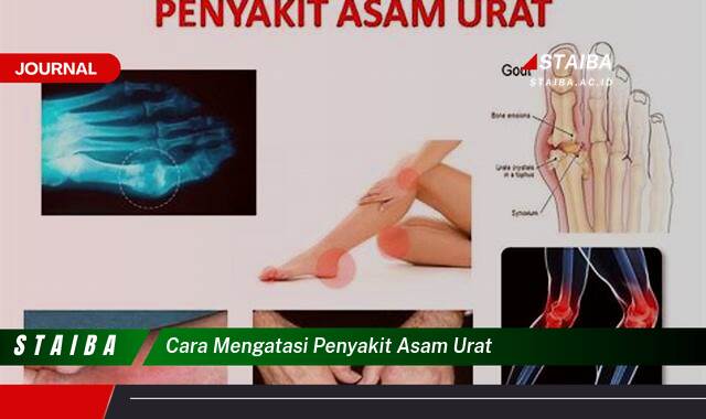 Ketahui Cara Mengatasi Penyakit Asam Urat dengan Cepat dan Alami