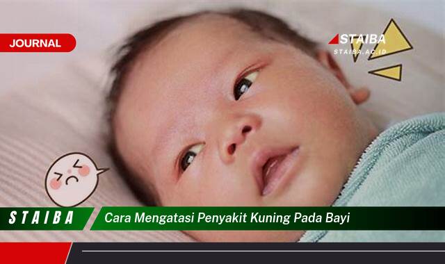 Ketahui Cara Mengatasi Penyakit Kuning pada Bayi Baru Lahir Secara Efektif dan Aman