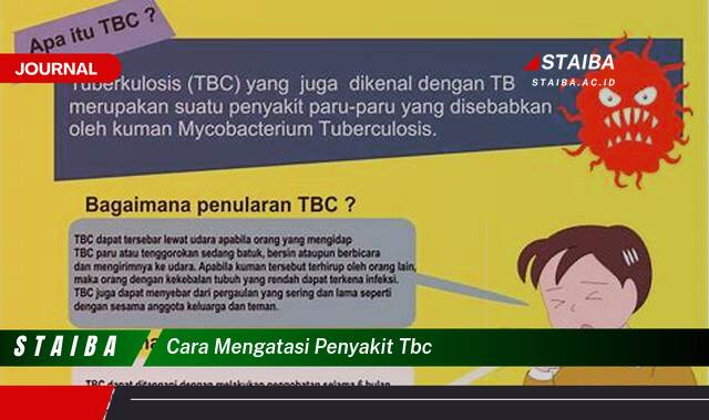 Ketahui Cara Mengatasi Penyakit TBC dan Sembuh Secara Total Ketahui Cara Mengatasi Penyakit TBC dan Sembuh Secara Total