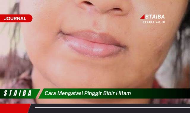 Ketahui Cara Mengatasi Pinggir Bibir Hitam Secara Alami dan Efektif