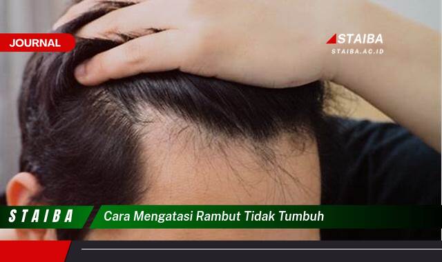 Ketahui Cara Mengatasi Rambut Tidak Tumbuh dan Dapatkan Kembali Mahkota Indahmu