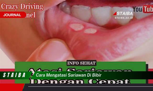Ketahui Cara Mengatasi Sariawan di Bibir dengan Cepat dan Ampuh