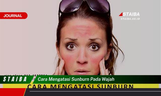 Ketahui Cara Mengatasi Sunburn pada Wajah Secara Efektif dan Alami