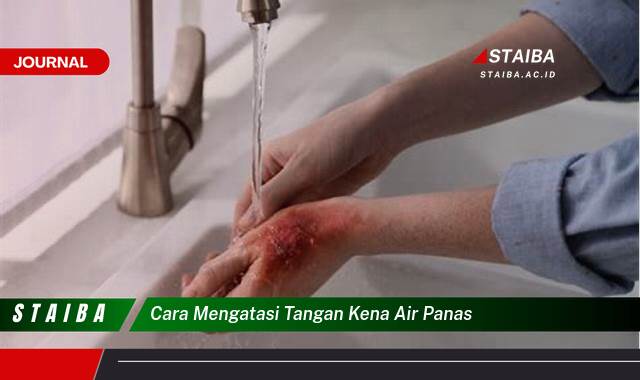 Ketahui Cara Mengatasi Tangan Kena Air Panas dengan Cepat dan Efektif untuk Meringankan Rasa Sakit