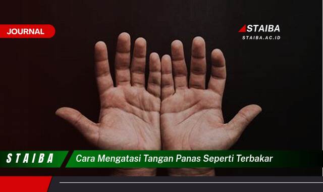 Ketahui Cara Mengatasi Tangan Panas Seperti Terbakar Secara Efektif dan Alami