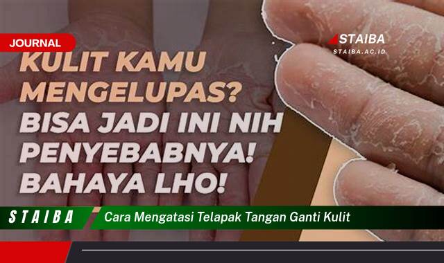 Ketahui Cara Mengatasi Telapak Tangan Ganti Kulit Secara Efektif dan Alami Ketahui Cara Mengatasi Telapak Tangan Ganti Kulit Secara Efektif dan Alami