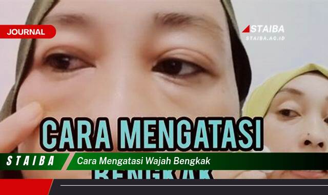 Ketahui Cara Mengatasi Wajah Bengkak Secara Alami dan Cepat Ketahui Cara Mengatasi Wajah Bengkak Secara Alami dan Cepat