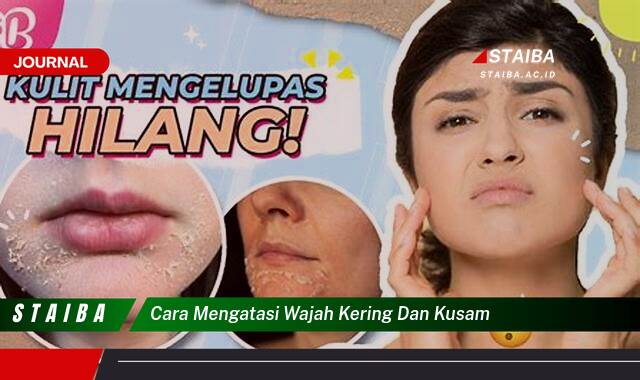 Ketahui Cara Mengatasi Wajah Kering dan Kusam Secara Alami dan Efektif